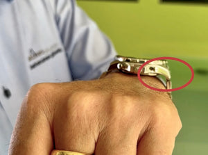 gezeigt wird ein Arm in der Nahaufnahme und eine große Uhr am Handgelenk die absteht verdeutlicht mit rotem Kreis